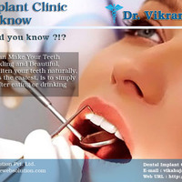 Contact India���s Best Dental Implant Clinic