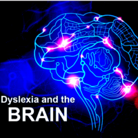 Dyslexia and the Brain - Resource Notebook