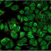 Extracting Green Fluorescent Protein from Bacteria