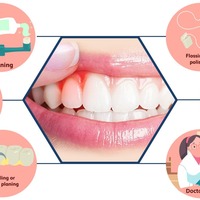Gum Diseases Treatments