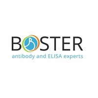 Boster Bio - Providing High Affinity Antibodies and Immunoassays