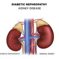 Different Types of Health Problems Kidney, Cancer, and Diabetes