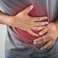 Digestive disorders and recipes