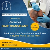 Best Hair Transplant in Delhi